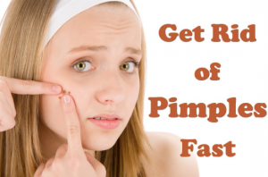 How To Get Rid Of Pimples