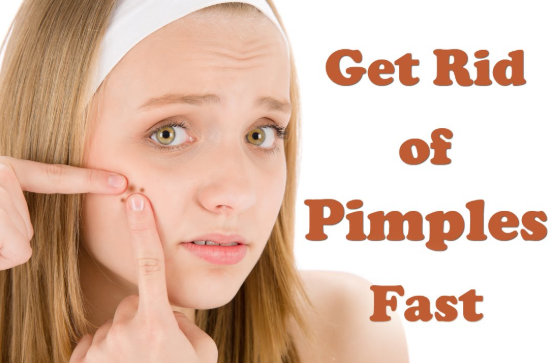 How To Get Rid Of Pimples